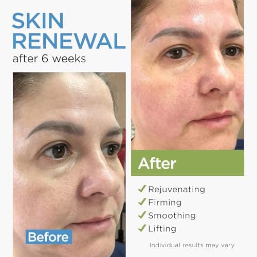 Collagen Face Cream with Stem Cells Retinol Hyaluronic Acid Niacinamide for All Skin Types - Anti-Aging Face Moisturizer with Airless Pump - Day & Night Cream for Wrinkles - Made in USA 1.7 Oz 2