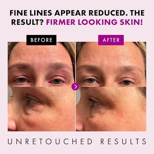 Eclat Skincare Anti Aging Face Cream - Face Moisturizer with Collagen Peptides, Hyaluronic Acid, & Vitamins C+E - Improves Fine Lines and Wrinkles - Day Cream for Women Anti Aging 50 ml 3