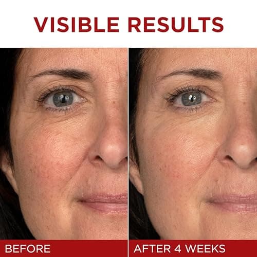 L'Oreal Paris Revitalift Triple Power Anti-Aging Face Moisturizer, Pro Retinol, Hyaluronic Acid & Vitamin C to Reduce Wrinkles, Firm & Brighten Skin, 1.7 Oz 4